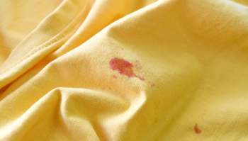 A yellow fabric with several visible stains.