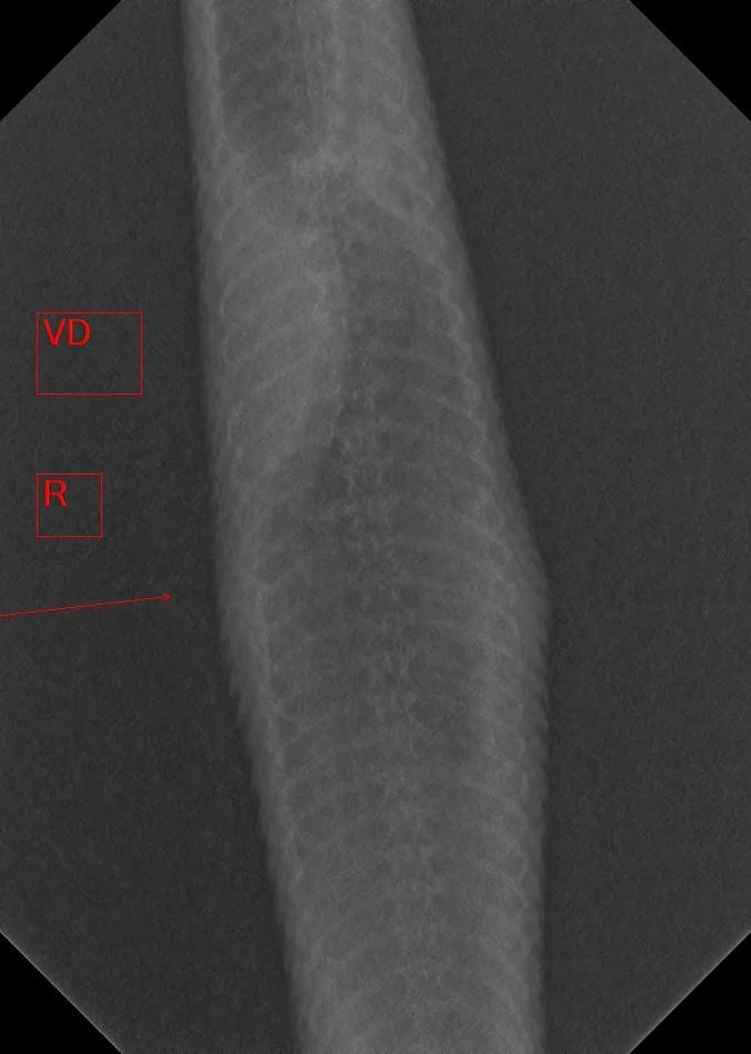 A radiograph of Tibby.